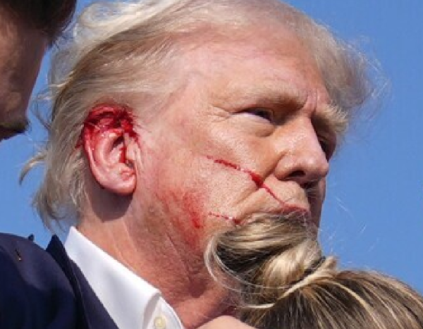 Closeup of Trump's Face showing his ear just after the shooting at his rally.