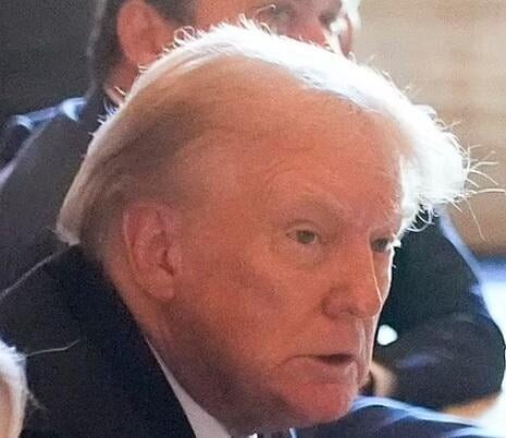 NSFL!! Massive Damage to Trump's Ear Revealed.